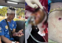 ពលរដ្ឋកម្ពុជារងរបួស៣នាក់ដោយសារការវាយប្រហាររបស់យោធាថៃនៅខេត្តឧត្ដរមានជ័យ